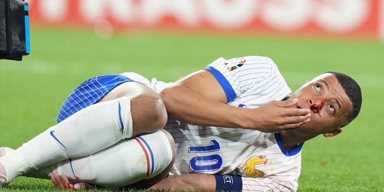 Imaju li “Trikolori” razloga za brigu? Mbappe se povrijedio i napustio teren