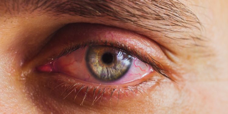 Naučnici došli do revolucionarnog otkrića kad su oči u pitanju. Evo šta tvrde