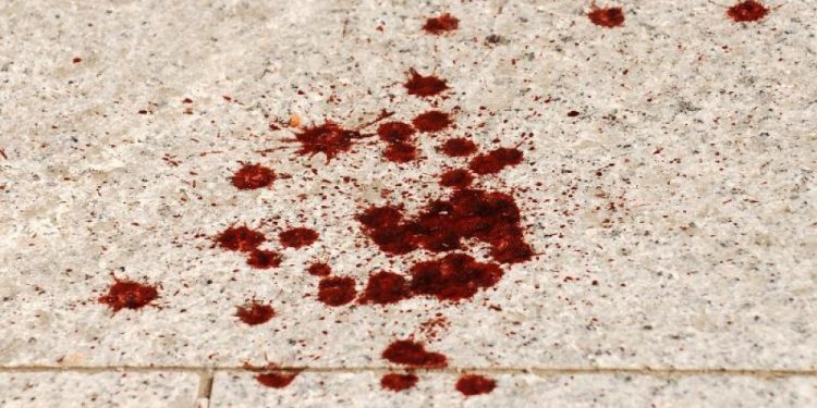 Policija dobila dojavu o muškarcu koji se čudno ponaša i drži kofer iz kojeg kapa krv. Ulsijedio je pravi užas