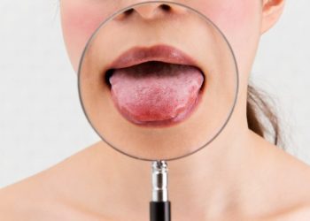 Primijetite li blagu žutu boju u ustima, hitno se obratite ljekaru: Može biti naznaka opake bolesti
