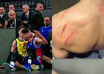 Bryant tvrdi da nije ugrizao Biberovića