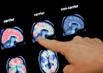 Ljudski mozak ne bi trebao biti budan nakon ponoći, upozoravaju naučnici. Misli koje vam tad dolaze mogu biti jako opasne