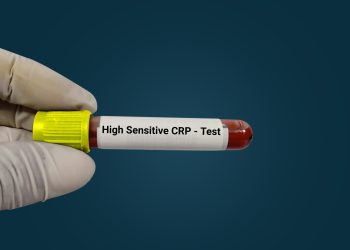 Povišen vam je CRP? Šta znače određene vrijednosti kod djece i kod odraslih